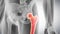 The femur bone