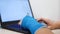 Fiberglass cast hand uses laptop program code