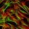 Fibroblasts (skin cells) labeled with fluorescent dyes