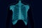Film chest x-ray PA upright : show normal human chest