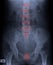 Film x-ray pelvis and spinal column.
