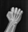 Film xray x-ray or radiograph of a hand and fingers in gestural language, manual communication, or signing aka sign language