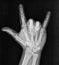 Film xray x-ray or radiograph of hand and fingers showing skeleton bones doing the sign language gesture for I love you with thumb