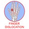 Finger Dislocation human medical organ vector illustratio.