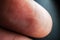 Fingerprint texture of finger skin