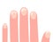 Fingers of the left hand with affected nails cartoon vector illustration