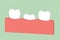 First tooth, tooth growing up from gum and between other teeth