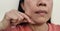 The flabbiness adipose sagging and wrinkles, Flabby and dullness on the face.