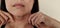 The flabbiness adipose sagging and wrinkles under the neck, cellulite under the chin.