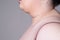 Flabby skin on the neck of an fat woman, female double chin on gray background