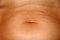 Flabby wrinkled abdomen. The navel is stretched.