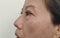 The Flabby wrinkles and freckles, dark spots and ptosis beside the eyelid