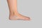 Flat foot of woman showing missing arch which can cause misalignment and orthopedic problems on white background