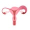 Flat illustration of human uterus demonstrating one healthy and one inflamed fallopian tube.