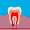 Flat style of dental disease with pain and inflammation. Medical illustration of tooth root inflammation, tooth root cyst,