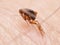 Flea Siphonaptera on human skin