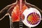 Flu viruses in human lungs