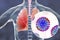 Flu viruses in human lungs
