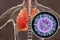 Flu viruses in human lungs