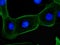 Fluorescent stem cells growing in culture showing microtubules in green and nucleus in blue