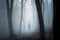 foggy forest with mysterious figure emerging from the mist