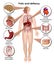 Folic acid defiency 3d medical  illustration infographic