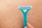 Foliculitis on hairy skin - shaving