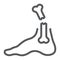 Foot broken line icon, medical and healthcare, leg injury sign, vector graphics, a linear pattern on a white background.