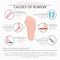 Foot deformation as medical desease infographic. Causes of bunion