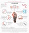 Foot deformation as medical desease infographic. Causes of bunion