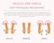 Foot deformation as medical desease infographic. Valgus and varus defect