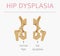 Foot deformation types, medical desease infographic. Hip dyspla