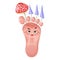 Foot nail fungus vector cartoon illustration. Parasitic mushrooms on leg. Fungal infection skin of feet, mycosis  toenail.