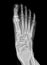 foot scan, film foot, foot pain, anatomy, ankle, arthritis, body, bone, bottom, broken, care, clinic, deformity, diagnosis,