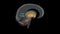 The forebrain structures include the caudate nucleus, the putamen, the nucleus accumbens and the globus pallidus