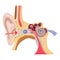 Foreign body in the inner ear.