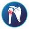 Fracture head of humerus icon. Vector flat design for radiology orthopedic research hospital for body joints