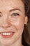 Freestyle. Young woman with freckles standing smiling cheerful half face close-up