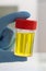 A fresh urine sample in a medical container