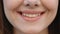 Front close up of caucasian woman, beautiful young human face with white skin. Girl wide smiling with healthy white