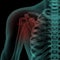 Front x-ray view of human painful shoulder