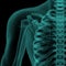 Front x-ray view of human shoulder