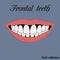 Frontal teeth