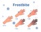 Frostbite stages, Vector cartoon illustration of hands