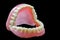 Full denture on black background