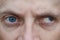full face macro photo of a man with strabismus and blindness of one eye. visual disability