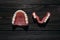 Full removable plastic denture of the jaws. A set of dentures on a dark background. Two acrylic dentures.
