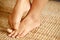 Fungal foot itching caused by biting feet