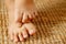 Fungal foot itching caused by biting feet