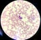 Fungus infection in white blood cells